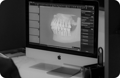Simulação do resultado com Smile Video 3D