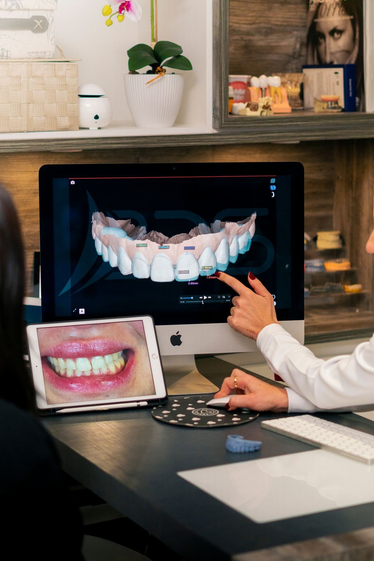 DSD (Digital Smile Design)