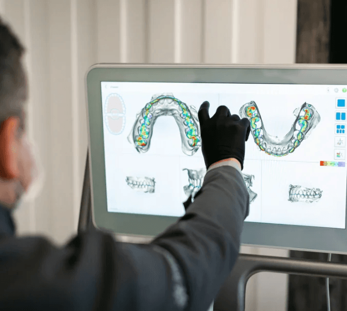 Implantes com guia 3D