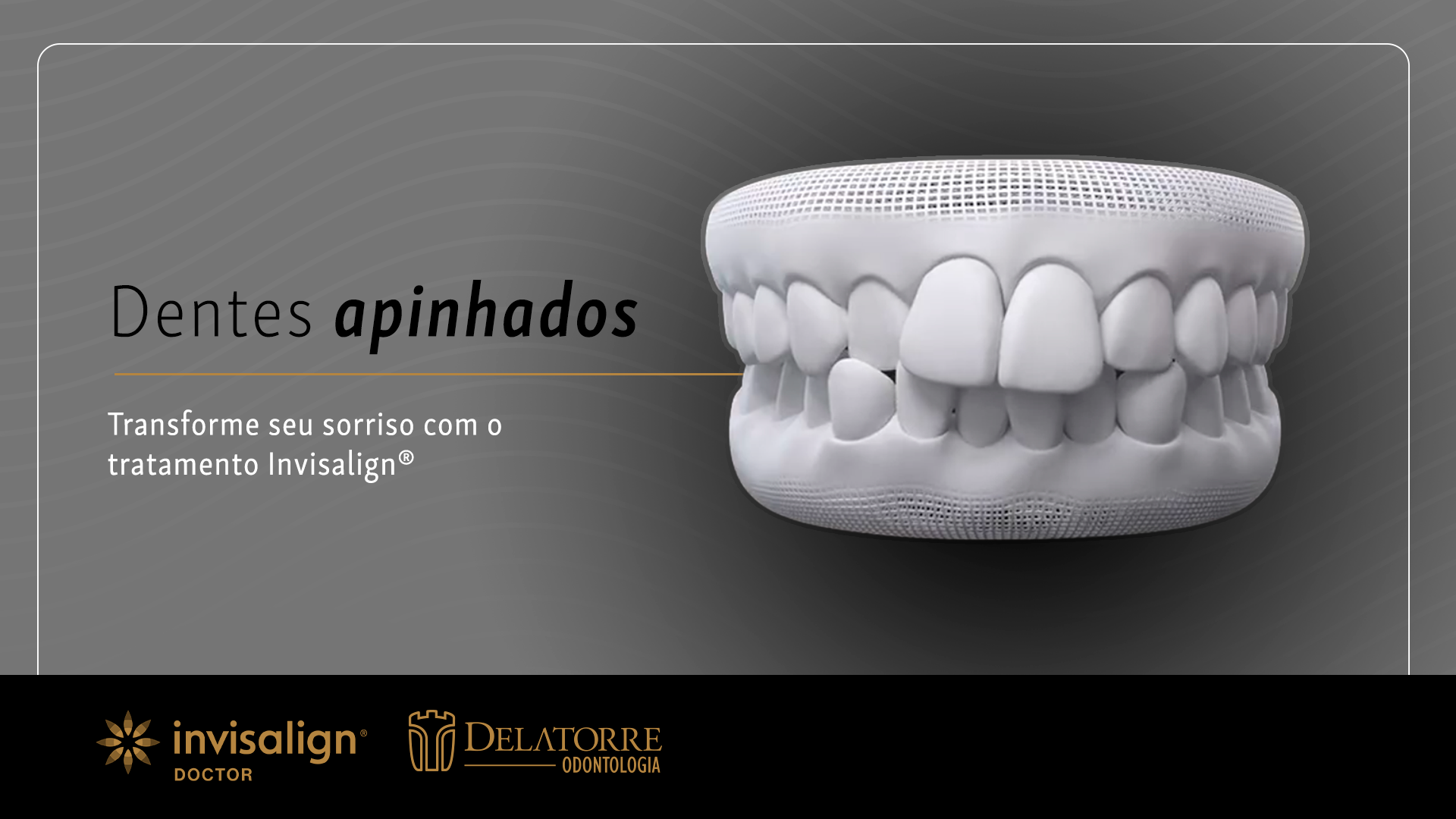 Invisalign Curitiba: Alinhador Transparente