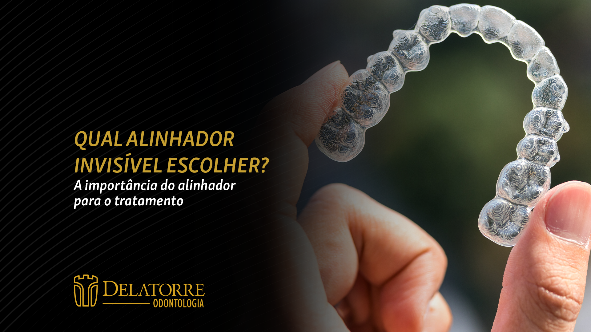 Invisalign Curitiba: Alinhador Transparente